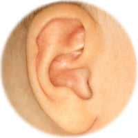 ear buddies splint has rounded the cartilage of this stahl's bar