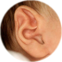 pointed 'elf' (stahl's bar) ear before being reshaped by ear buddies splints