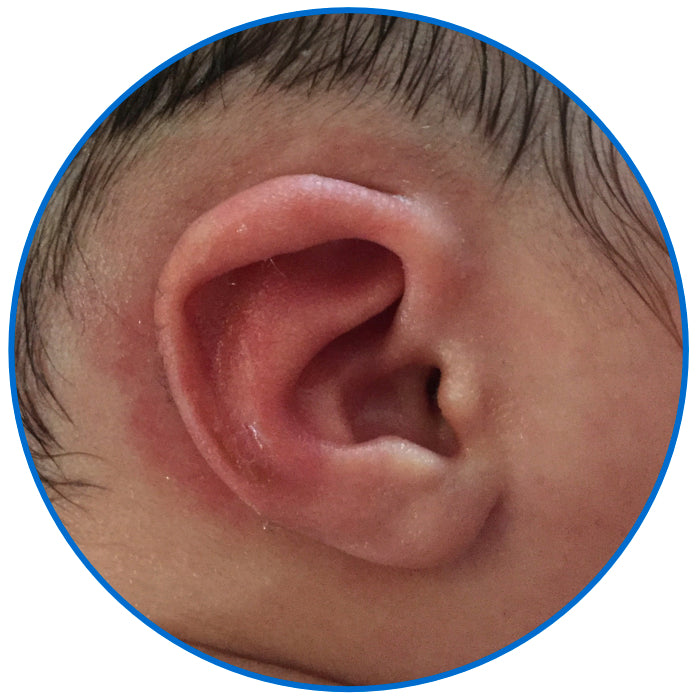 corrected lop ear baby ear buddies parent review Canada