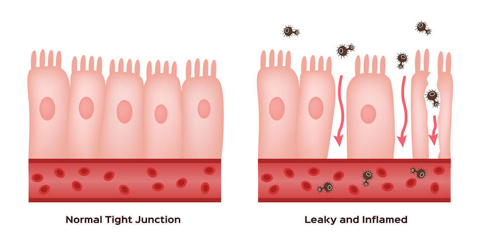 normal vs leaky gut junction