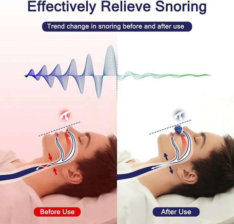 2024 Micro CPAP travel Machine for Sleep Apnea Relief - Sleep apnea machine  - Anti Snoring - Sleep apnea treatment – DOLCYS