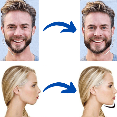 strengthen jaw before after