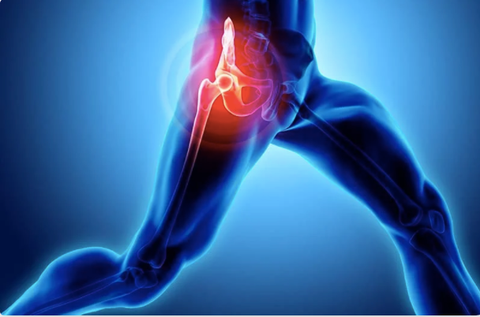 Hip Flexor Injury- Hip Pain