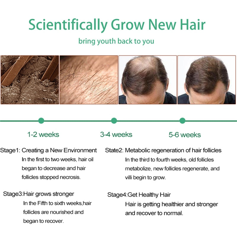 Ginger Germinal Oil 7 Days Hair Regrowth