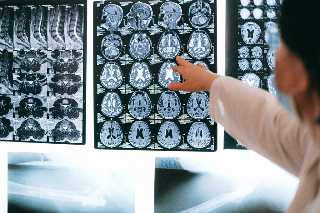 brain-scan-fluoride