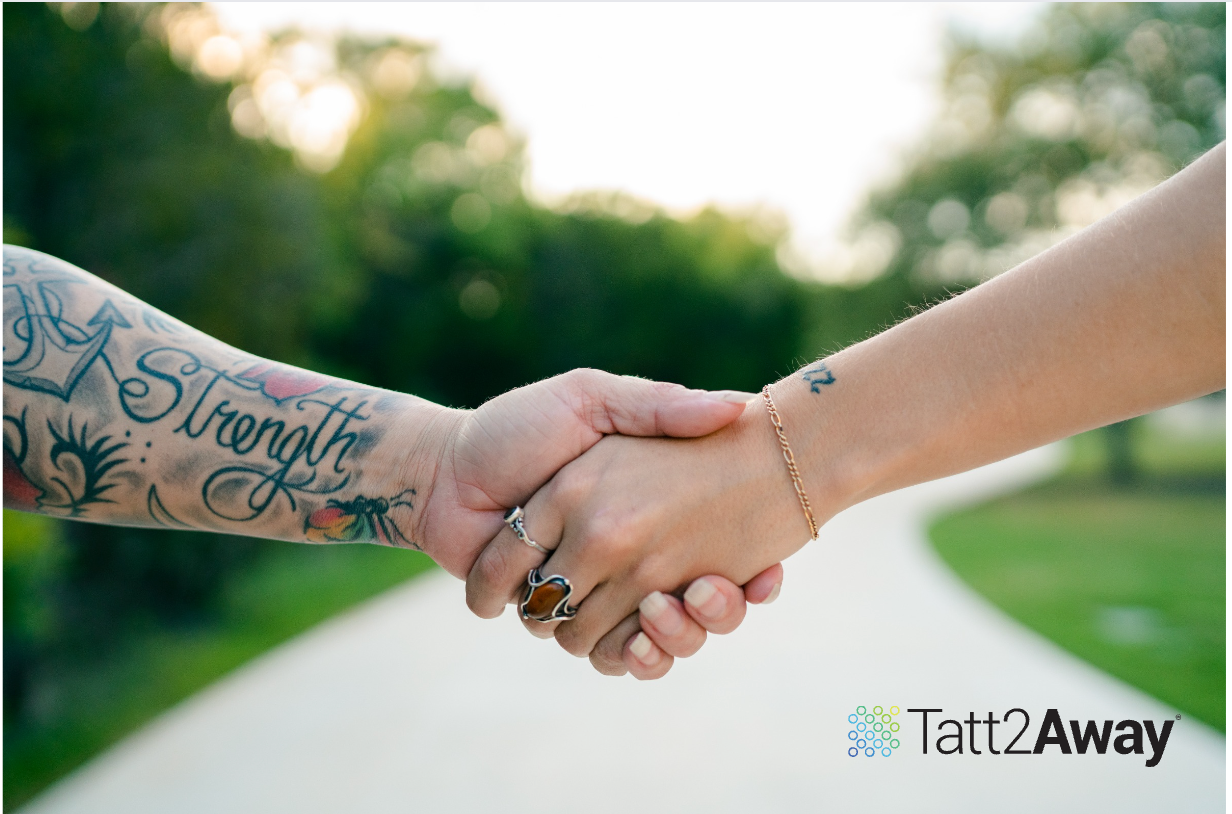 The Worlds Tattoo Removal Experts on Instagram Have you ever wondered  what the tattoo removal process looks like on color tattoos Wonder no  more This progress is out of our Salt Lake 