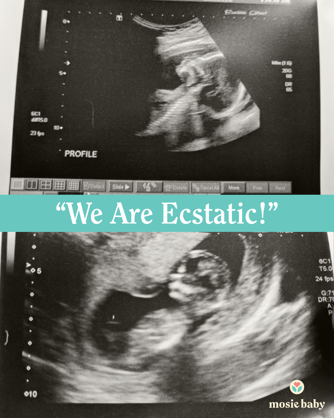 Sonogram of a Mosie Baby with the quote "we are ecstatic!"