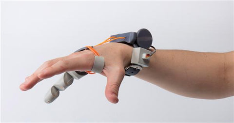 prosthetic hand