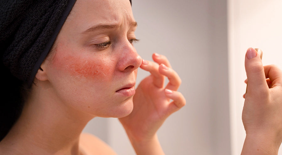 Woman Treating Sun Damaged Skin