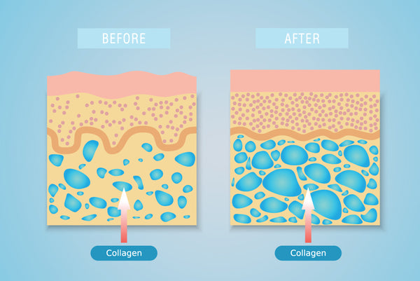 skin with more moisture resulting from intake of collagen