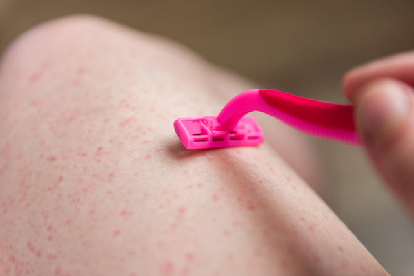 woman with razor burn, shaving her leg