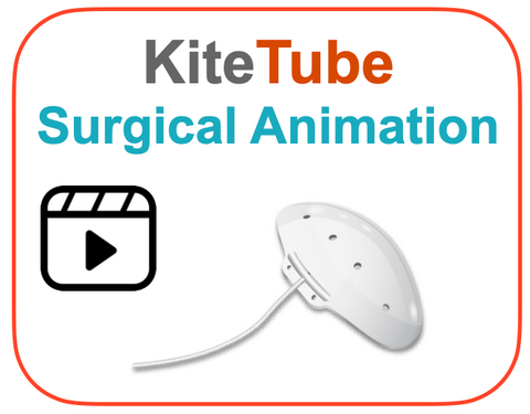 Surgical Animation