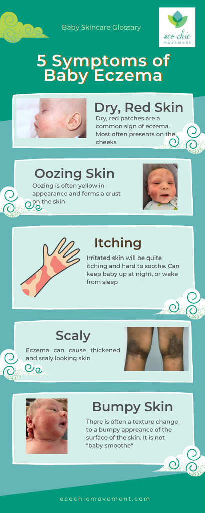 a list of the most common symptoms of baby eczema