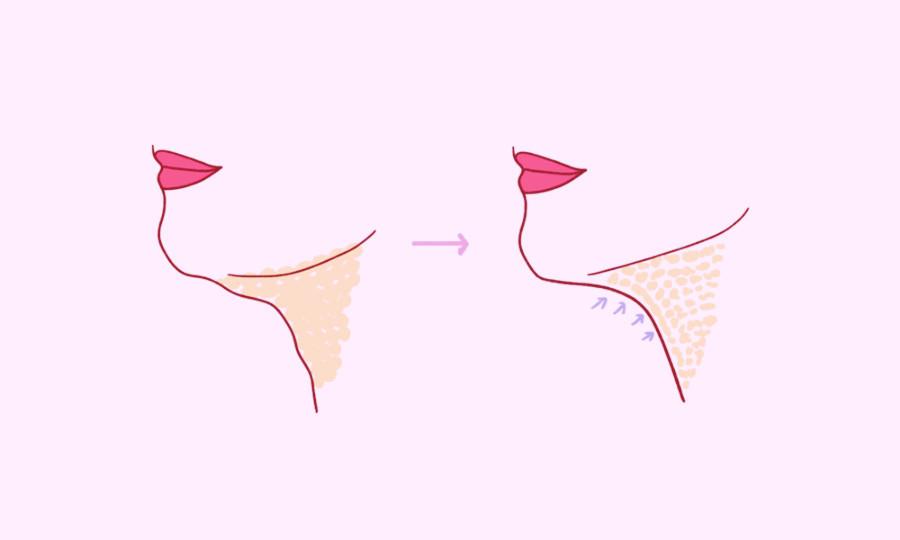 Fat Dissolving Injections In Korea The Composition Mystery