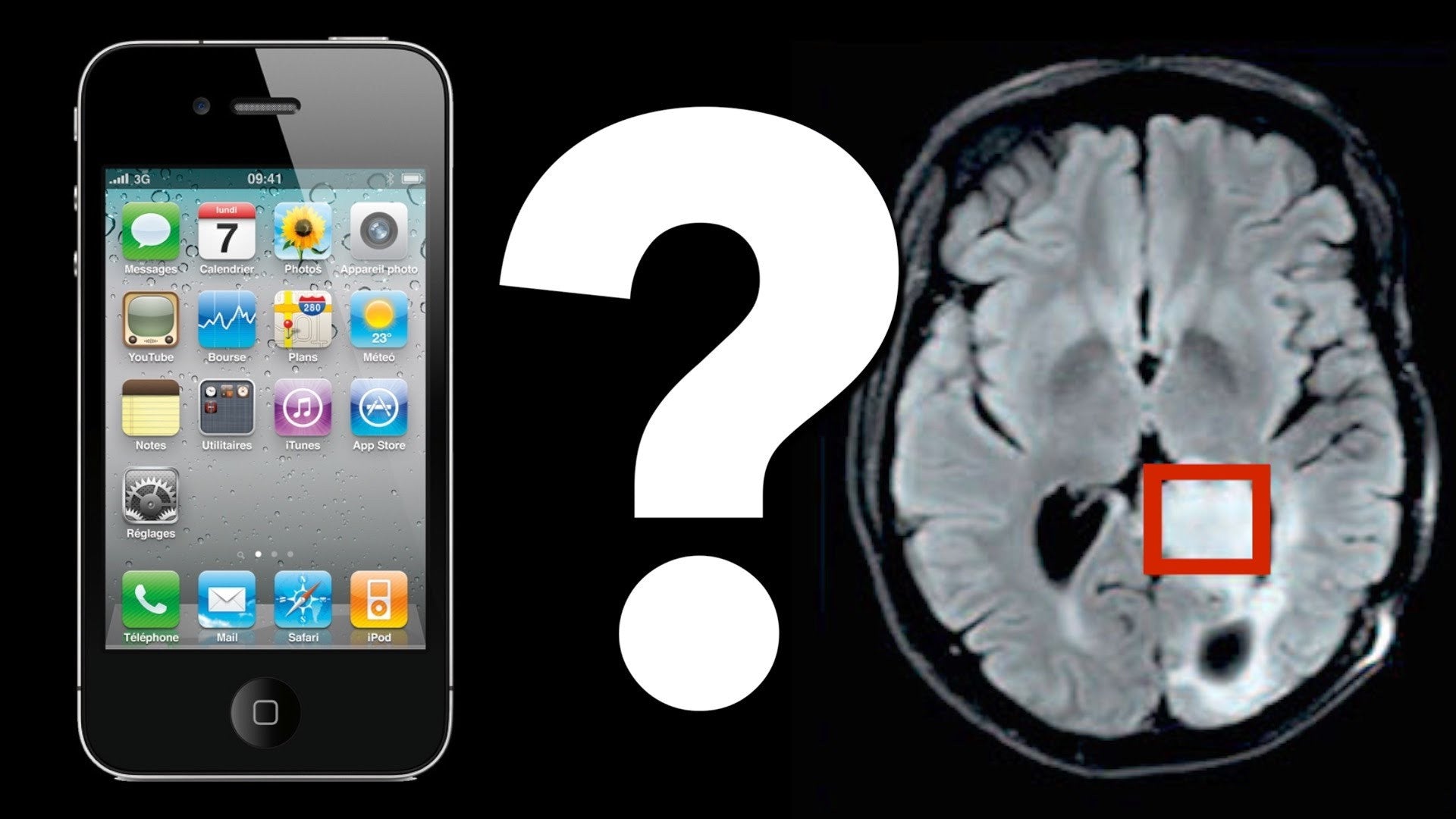 link between phone radiation and brain tumor