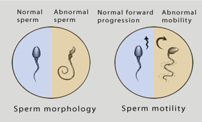 sperm mortility analysis