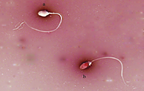Sperm Viability