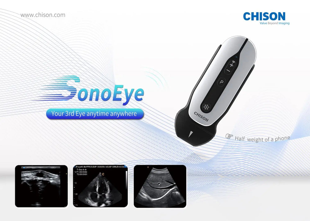 Compra Ecógrafo portátil Chison SonoEye P3 de color - sonda Phase Array  DoctorShop