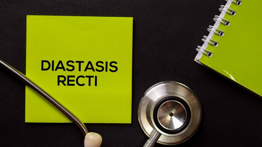 diastatsis recti in pregnancy