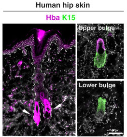 human hip skin IHC