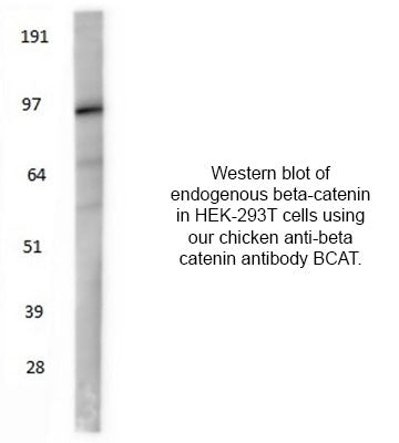 beta catenin western blot