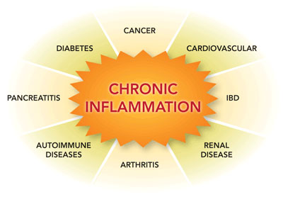Chronic inflammation influences DNA and gene expression - Nutrigenomics Malaysia