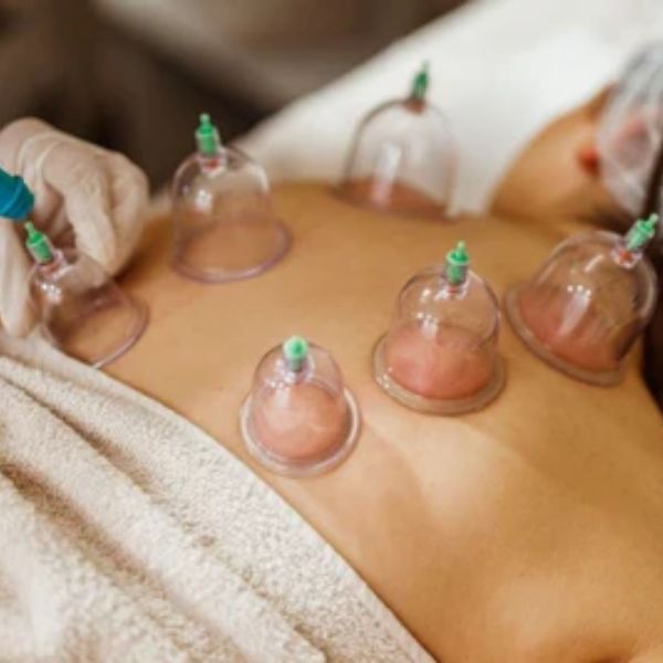 cupping