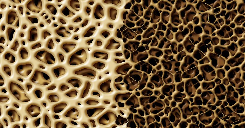 bone density; Hormonal Changes and their Influence on Bone and Muscle Decline  