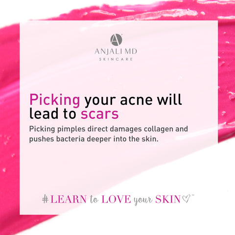Picking acne causes acne scars and scarring.