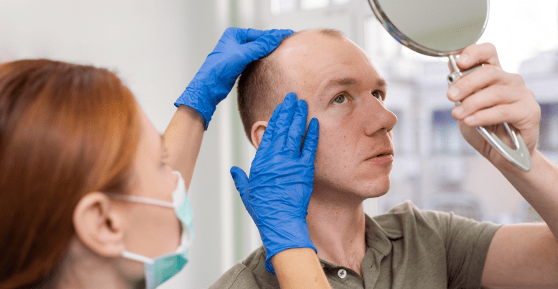 Benefits of Scalp Micropigmentation