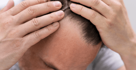 How Much Does Scalp Micropigmentation Cost