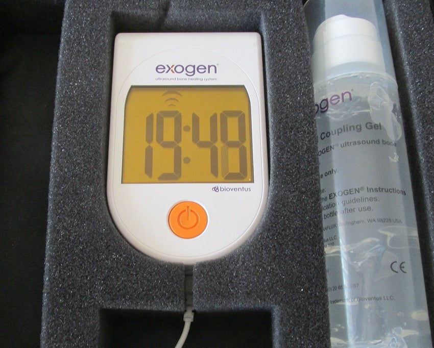 exogen bone stimulator