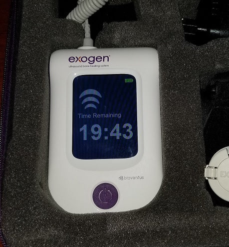 exogen bone stimulator