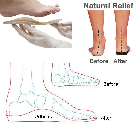 best orthopedic flats