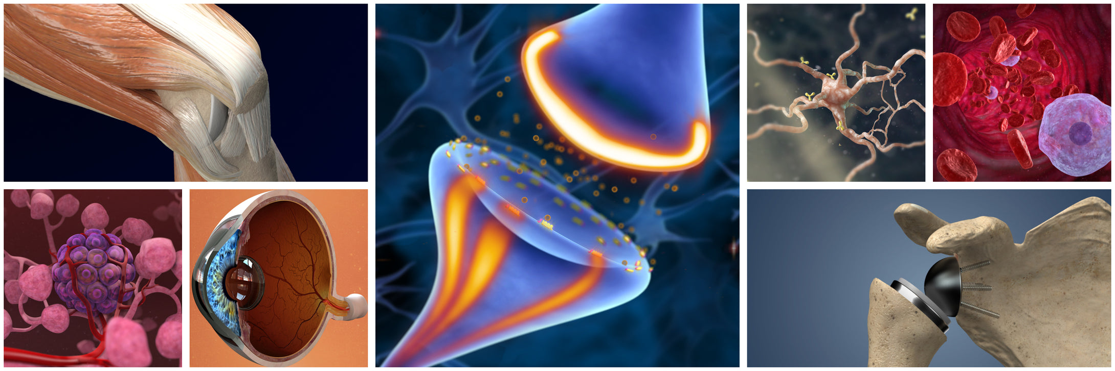 Understand Com Medical Animations And Illustrations