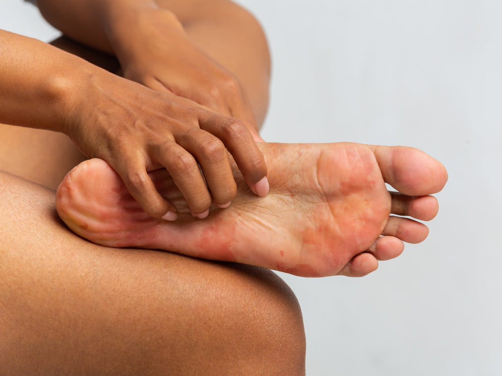 Itchy Swollen Areas on Your Fingers and Toes? It Could Be Chilblains!:  Hubert Lee, DPM: Podiatrist