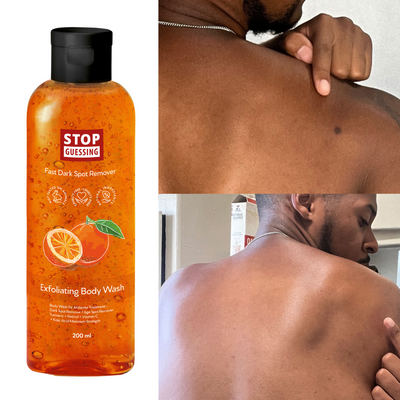 The Fast Dark Spot Remover Body Wash by Stop Guessing, BioFormula Select
