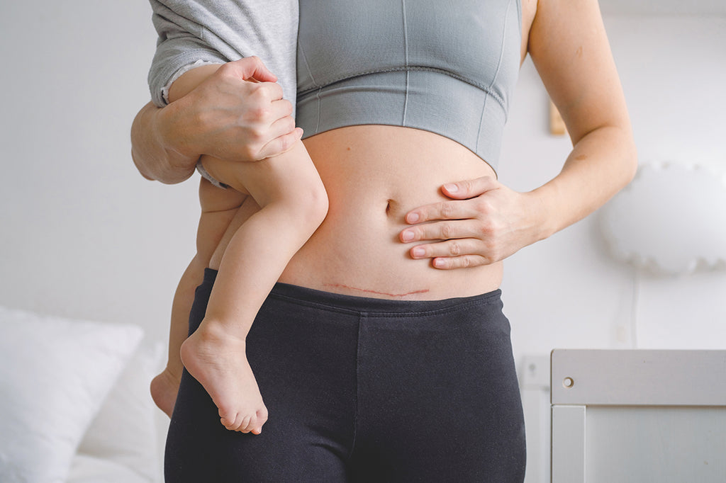 Woman grabbing her belly while holding a child