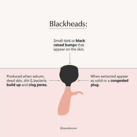 blackhead infographic