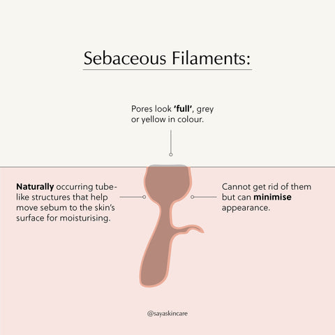 sebaceous filament infographic
