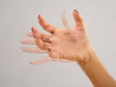Close-up of a hand displaying signs of finger tremors.
