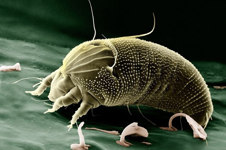 dust mite miscroscopic