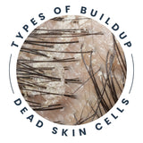 Types of buildup - Dead Skin Cells