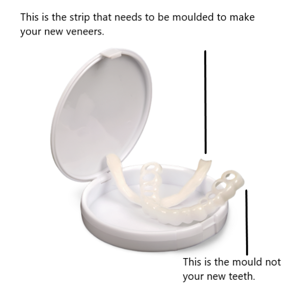 Glamza Get Set Smile Veneers 9