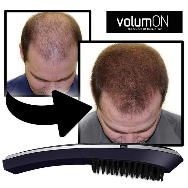 Volumon Laser Hair Massage Comb - Scalp Massage and Hair Growth 0