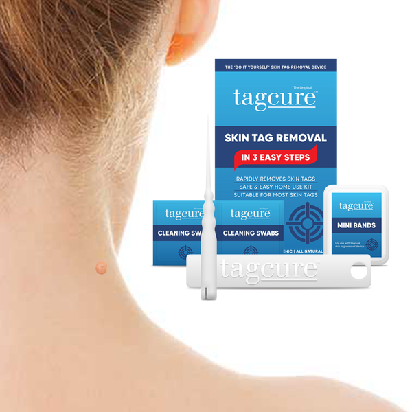 Tagcure Skin Tag Removal Device & Tagcure Top Up Pack - For Skin Tags 0.5cm or Less - Unisex - COMPLETE KIT 2