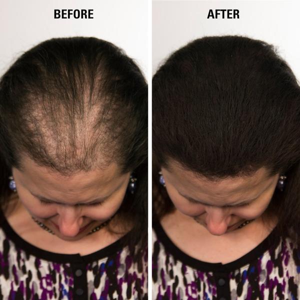 Volumon Hair Loss Building Fibres - KERATIN 28g 3