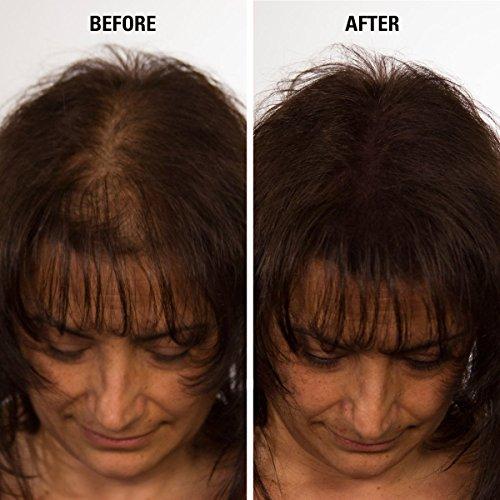 Volumon Hair Loss Building Fibres - COTTON 28g - For Men & Women! 12