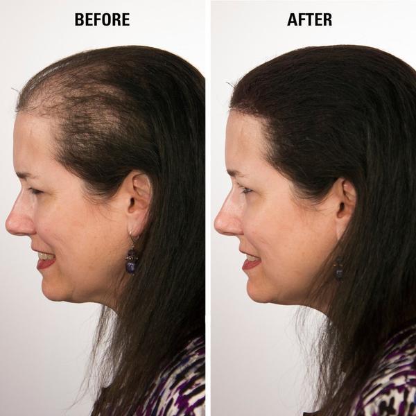 Volumon Hair Loss Building Fibres - COTTON 28g - For Men & Women! 9