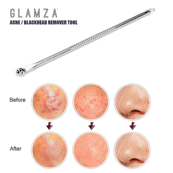 Glamza Double Ended Spot Removal Tool 1